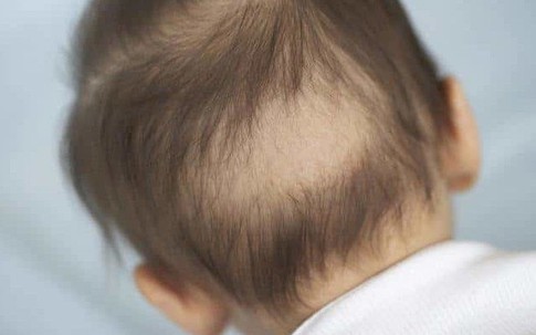 Bổ sung vitamin D sai cách khiến con thấp còi