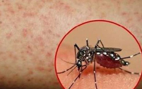 Quên điều này, bạn tự rước bệnh chết người vào chính mình và người thân