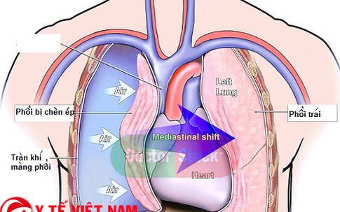 Những bệnh tiềm ẩn khi hát karaoke ai cũng dễ mắc phải