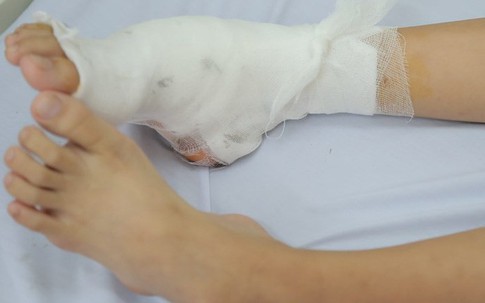 Bé gái ở Hà Nội có bàn chân dị dạng siêu hiếm gặp, 7 năm không tìm ra bệnh