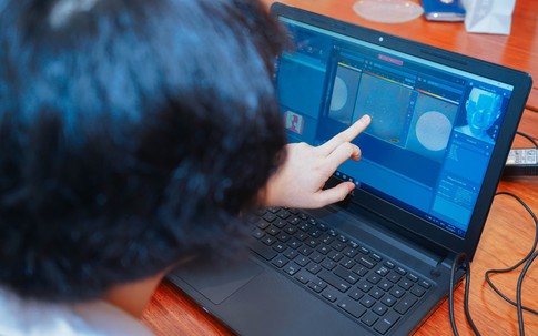 Chị em đang phát sốt với chương trình “Soi da miễn phí nhận quà hết ý” của Collagen Tây Thi New