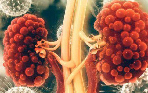 Thận là "nhà máy lọc nước" của cơ thể: Ai muốn giữ thận khỏe mạnh nên làm 5 việc