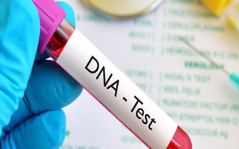 Chi cả núi tiền để xét nghiệm ADN xem con có phải “thần đồng”