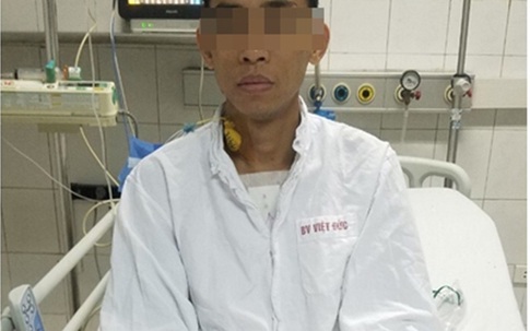 Hi hữu: Sửa súng săn, người đàn ông bị súng cướp cò, đạn găm trúng ngực