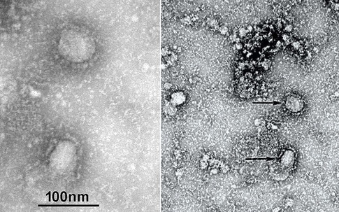 TQ công bố "chân dung" virus corona: Sự nguy hiểm chết người đằng sau tử thần nhỏ hơn cả bụi siêu mịn