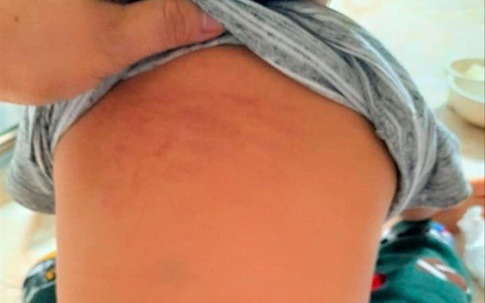 Đình chỉ 2 cô giáo mầm non bị tố bắt trẻ 15 tháng tuổi "uống nước bồn cầu" ở Ninh Bình