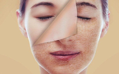 Da mềm ẩm suốt mùa hanh khô: Bác sĩ da liễu tiết lộ nguyên tắc vàng, khỏi lo bệnh da khô gõ cửa!