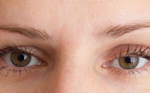 Sụp mí mắt: Nguyên nhân, tác hại, hướng điều trị an toàn không phải ai cũng biết