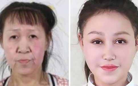 Màn lột xác của cô bé 15 tuổi nhưng mặt nhăn nheo, chảy xệ như cụ già 60 tuổi