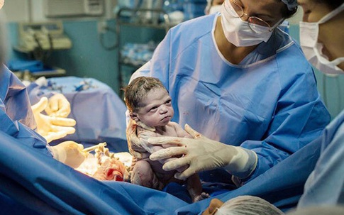 Hài hước khoảnh khắc em bé 'lườm' bác sĩ khi chào đời
