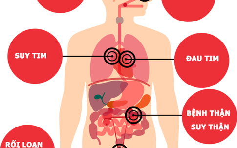Bệnh tăng huyết áp: Hiểu đúng để phòng ngừa tốt hơn
