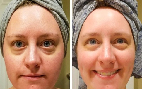 6 lý do nên thêm vitamin C vào chu trình dưỡng da