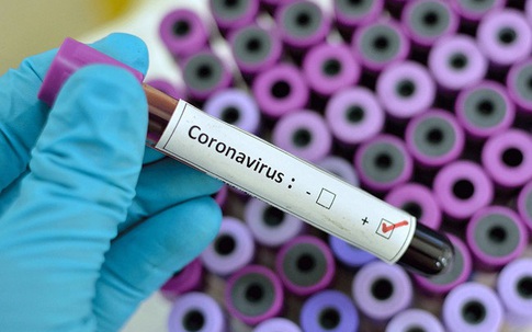 Chuyên gia lý giải vì sao có những bệnh nhân xét nghiệm âm tính rồi lại dương với SARS-CoV-2