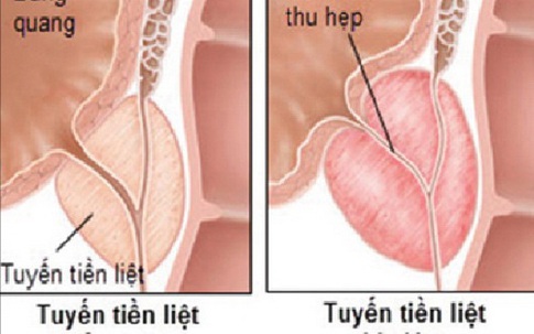 Những phương thuốc từ cỏ nhọ nồi