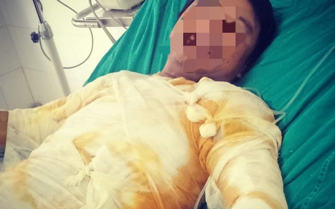 Hà Tĩnh: Sửa sự cố điện, nam công nhân bị điện phóng gây bỏng nặng