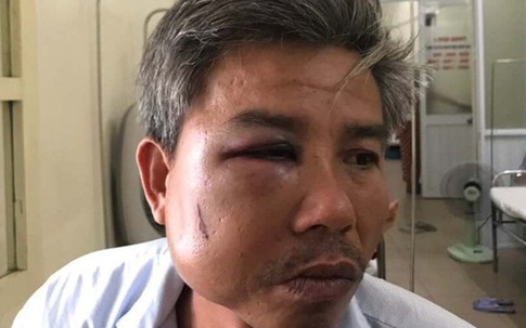 Chủ quán cà phê đạp vào mặt nhân viên cây xanh bị khởi tố