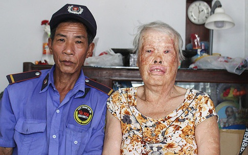 Hạnh phúc muộn của 'người đàn bà napalm'