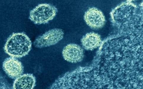 Chủng virus cúm mới được phát hiện ở Trung Quốc có nguy hiểm?