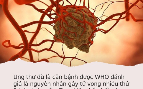 Sáng nào ngủ dậy cũng thấy cơ thể có 4 biểu hiện lạ này, bạn cần phải đi khám ung thư gan ngay lập tức