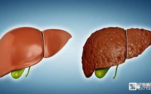 Người có tuổi thọ ngắn thường có đặc điểm "2 dày 3 cứng" trên cơ thể, dù chỉ có 1 trong số đặc điểm này thì cũng không khỏe mạnh