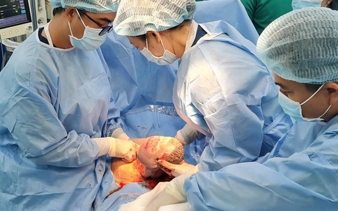 TP.HCM: Bác sĩ phối hợp cứu sống bé sơ sinh bị dị tật u quái khổng lồ