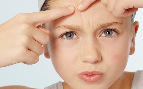 Mụn trứng cá mọc to chình ình trên mặt vì cứ ăn thả phanh loại thực phẩm ngon miệng này