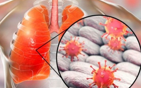5 căn bệnh gây tử vong cao nhất và cách phòng chống