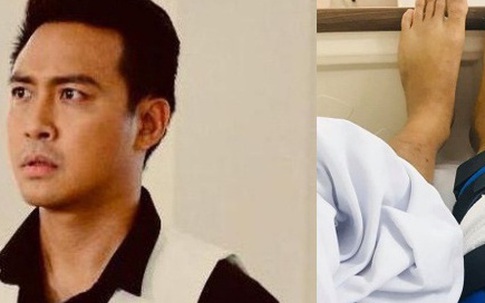 Thanh Duy ngã cầu thang, bị đứt dây chằng đầu gối