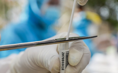 Bé một tuổi nhiễm nCoV bớt tiêu chảy