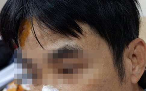 Người đàn ông bị chó becgie tấn công