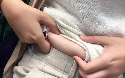 Tăng cân 10kg, đến phòng khám nhờ tư vấn cách giảm cân, người phụ nữ không ngờ mình mắc ung thư giai đoạn 3