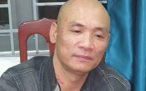 Đại úy cảnh sát gãy ngón tay khi khống chế kẻ côn đồ