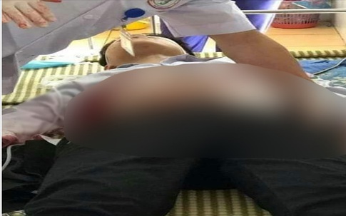 Học sinh cấp 2 dùng dao đâm bạn
