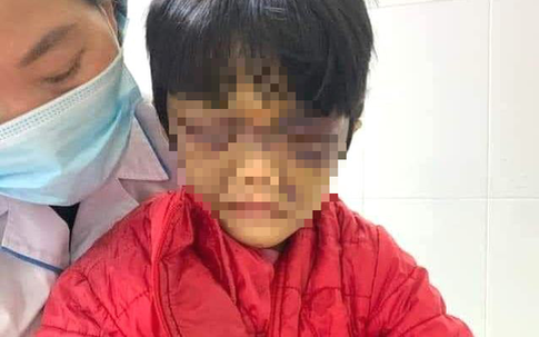 Bức xúc: Bé gái 6 tuổi ở Hải Dương bị mẹ đẻ đánh, nhốt trong phòng trọ