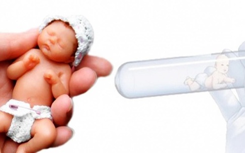 Những ai cần làm thụ tinh ống nghiệm IVF?