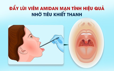 Đẩy lùi viêm amidan mạn tính hiệu quả nhờ Tiêu Khiết Thanh