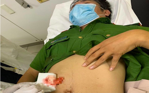Chiến sĩ công an ở Thừa Thiên Huế bị đâm trọng thương khi đang làm nhiệm vụ