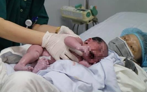 TP.HCM cần nỗ lực giải quyết tình trạng mức sinh thấp