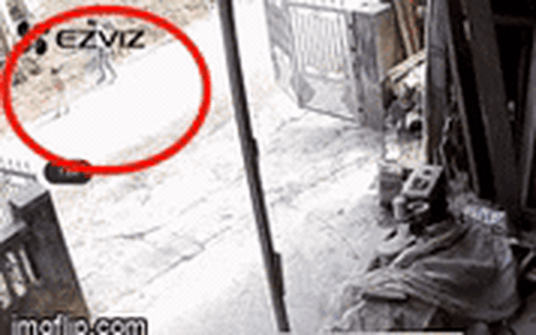 Sức khỏe của cháu bé 2 tuổi bị chó Becgie nhà hàng xóm cắn kinh hoàng hiện ra sao?