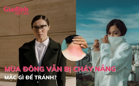 Mùa Đông vẫn có thể bị cháy nắng, mặc gì để tránh?