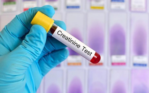 Nhờ dùng sản phẩm thảo dược, nhiều người bị suy thận độ 1 đã cải thiện chỉ số creatinin