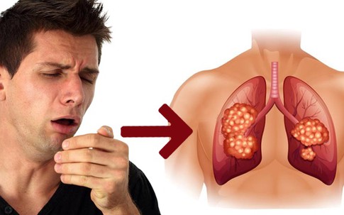 Nếu 1 trong 4 vấn đề này thường xuyên xuất hiện, rất có thể ung thư đang “gõ cửa”