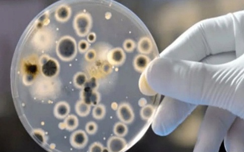 Mỹ phát hiện ca bệnh nấm nguy hiểm chết người có thể "kháng mọi loại thuốc"