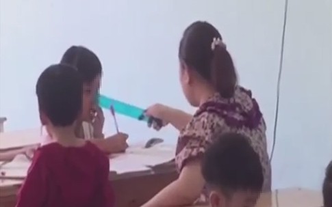 Kết luận vụ nghi vấn nữ giáo viên mầm non dùng thước kẻ đánh gãy răng học sinh