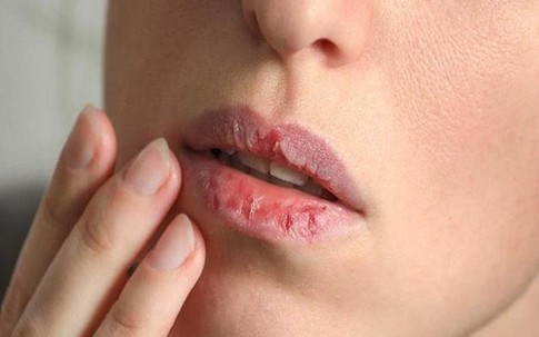 Phụ nữ bỗng dưng thấy 4 tín hiệu kỳ lạ này trên cơ thể có nghĩa là lượng đường trong máu đang cao quá mức, cần nhanh chóng đi khám