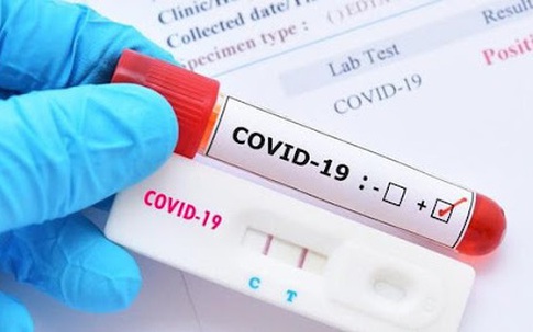 Bộ Y tế đề nghị tăng cường kiểm soát giá dịch vụ chẩn đoán COVID-19