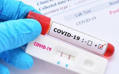 Bộ Y tế: Không xét nghiệm COVID-19 với người tiêm đủ liều vaccine tại cơ sở sản xuất, kinh doanh