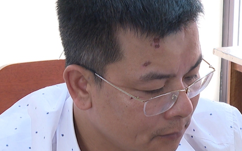 Khởi tố đối tượng lăng mạ, dùng điếu thuốc lá đang cháy dúi vào mặt một cán bộ công an