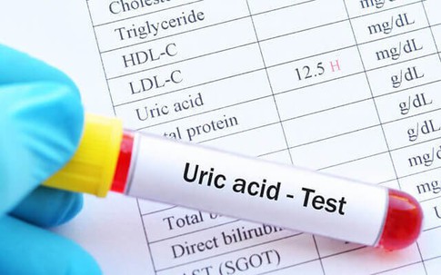 Người đàn ông hoang mang khi chỉ số acid uric tăng đột biến mà chưa có triệu chứng gout