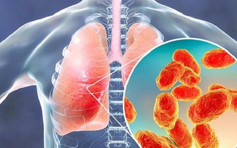 7 biện pháp phòng ngừa viêm phổi